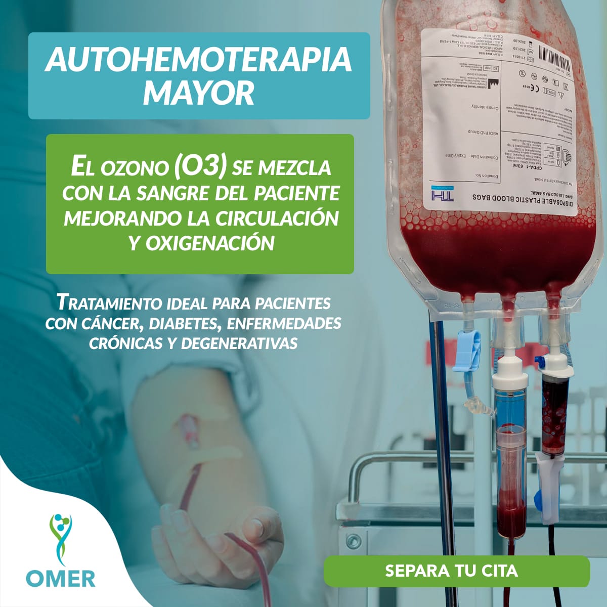 servicio
