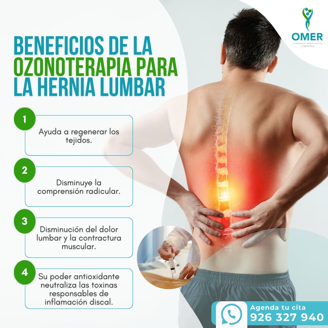 servicio
